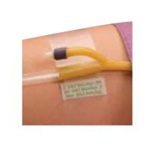 Dale Hold-N-Place Adhesive Patch Foley Catheter Holder, One Size, Latex-Free