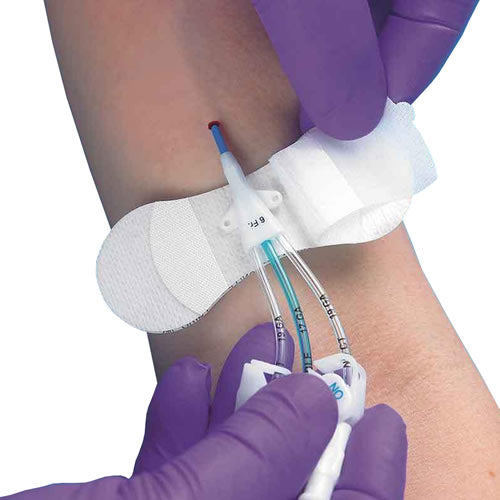 TIDI Grip-Lok Securement Device for Catheters