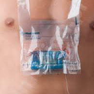 Mini-Med Distribution Centre Shower Pak Plastic Pouch, Single-use, For Showering with all Insulin Pump Models