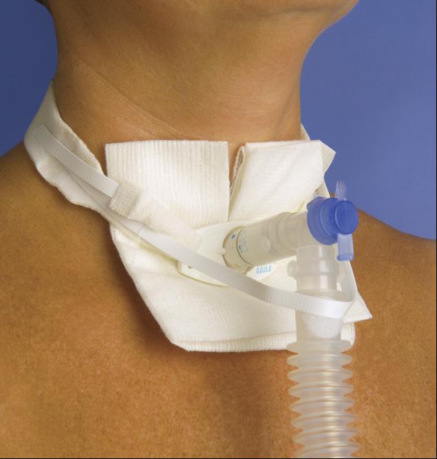 Pepper Medical One Piece Adult Trach-Tie with Ventilator Anti-disconnect Device